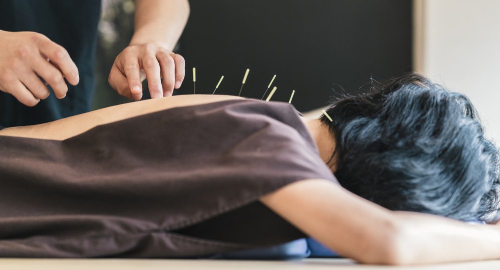 Get Acupuncture to Relieve Physical and Mental Conditions