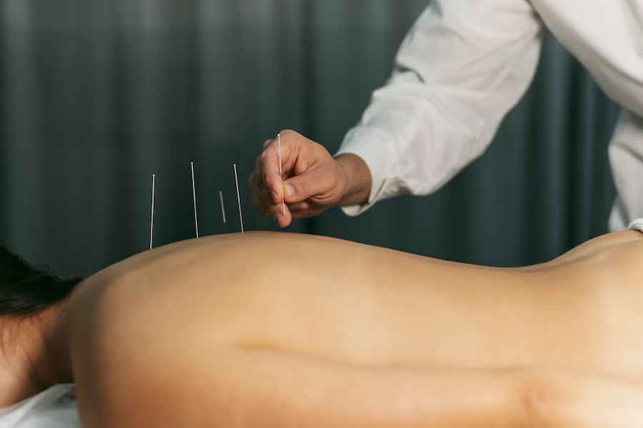 Acupuncture For Frozen Shoulder