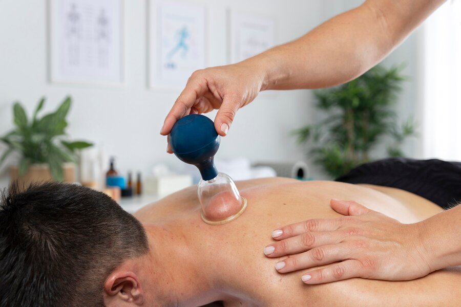 Cupping Therapy Technique