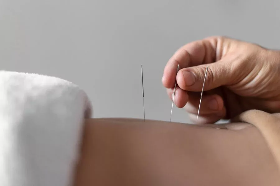 Acupuncture for gallbladder