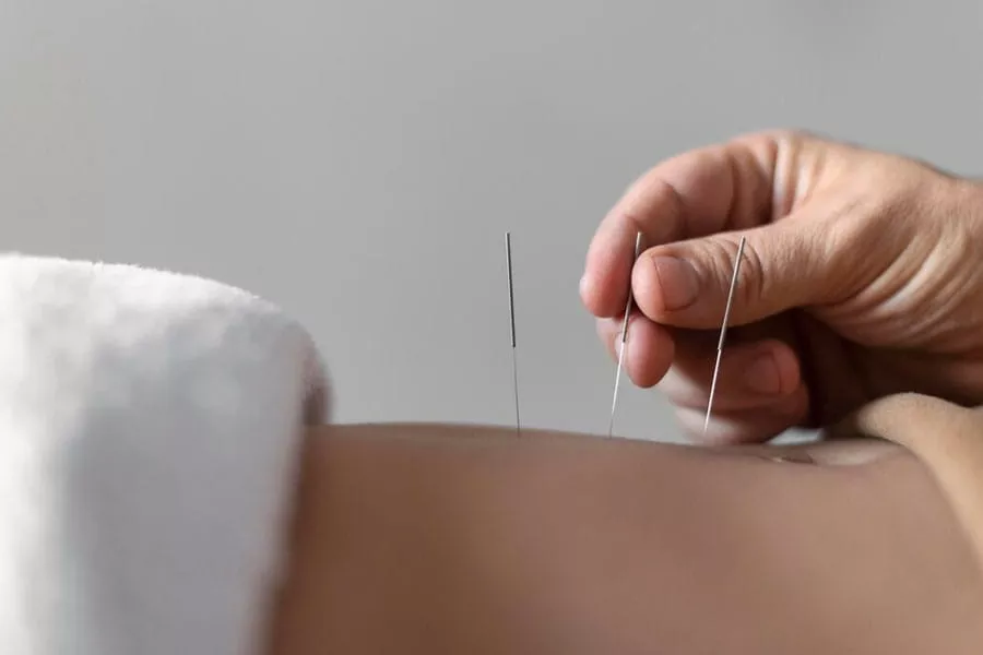 Acupuncture Supports Digestive Health