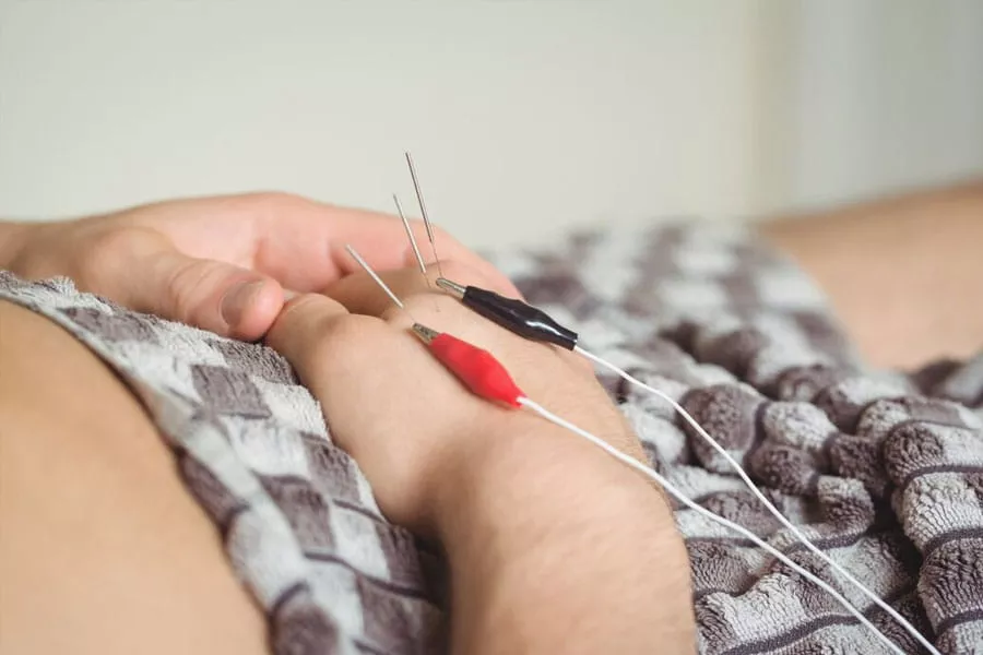 Acupuncture Supports Digestive Balance