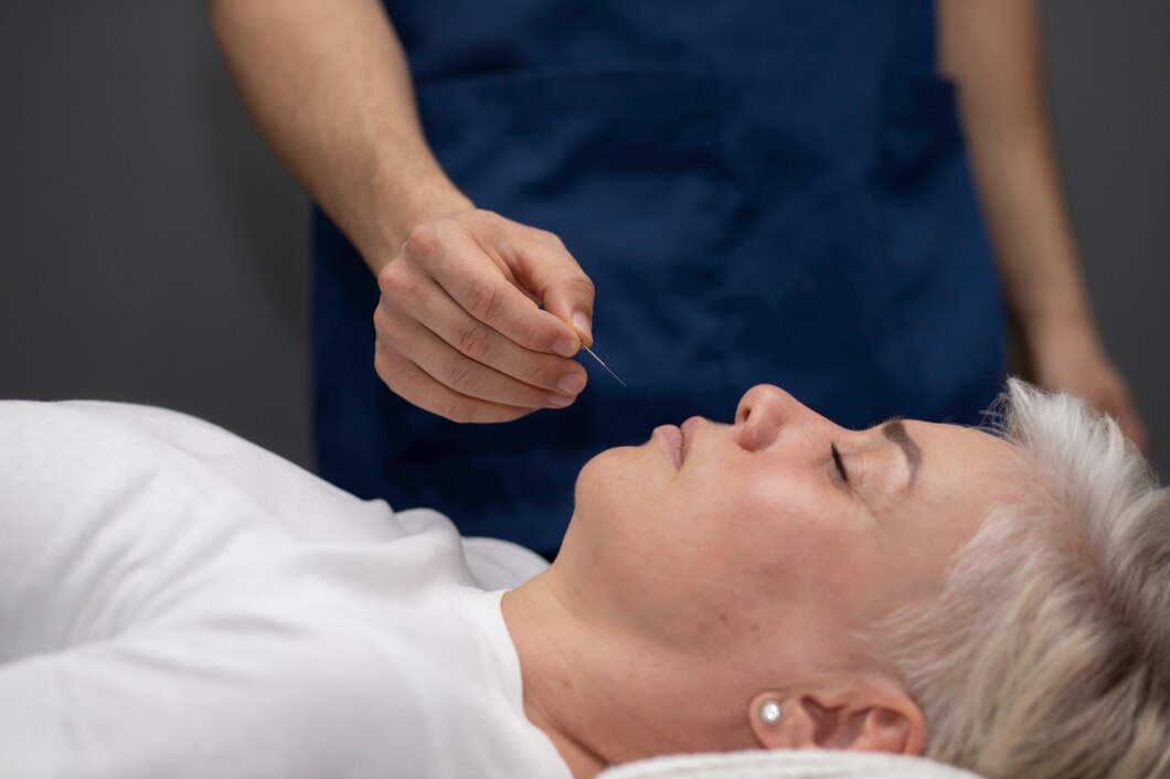 Acupuncture Supports Pain Relief Naturally